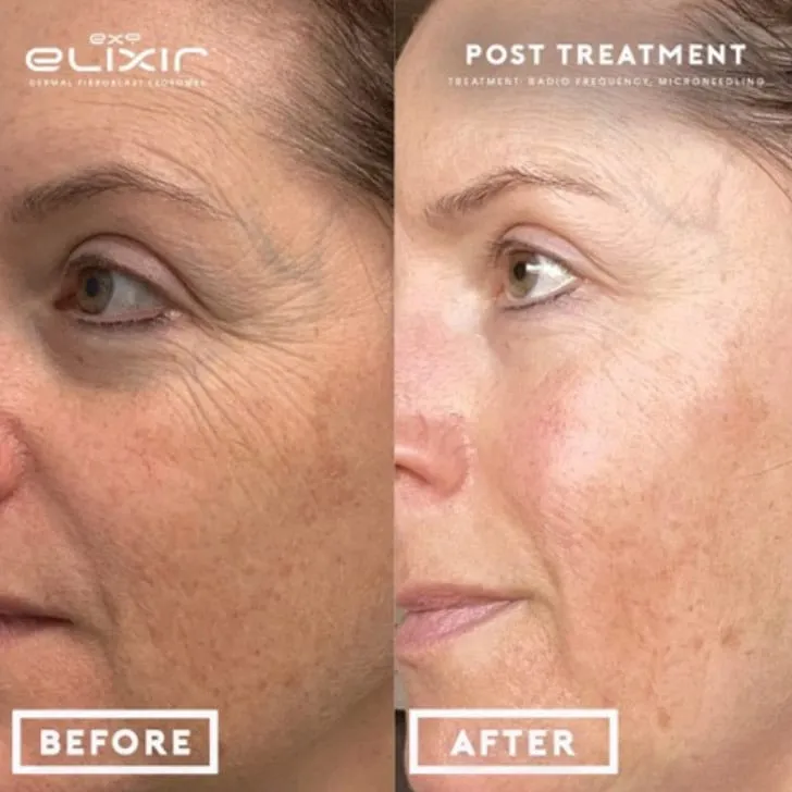 Anti-Inflammatory Proteins Are The Answer To Youthful Skin