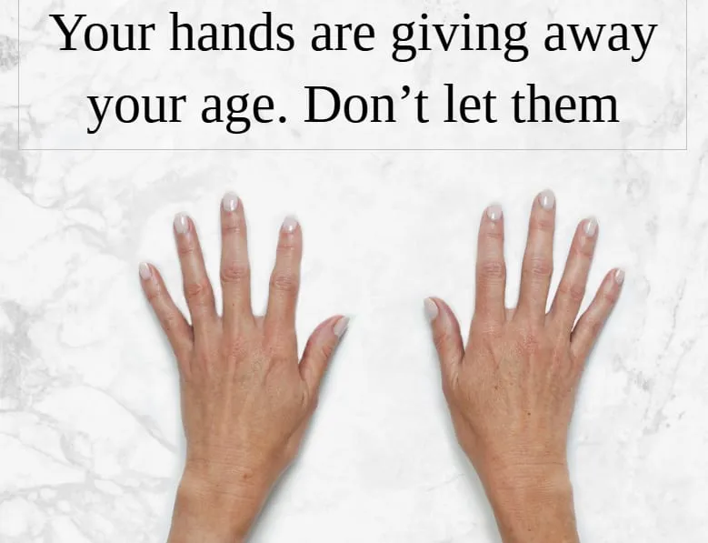 What’s giving away your age??? It’s not forehead wrinkles. It’s your hands